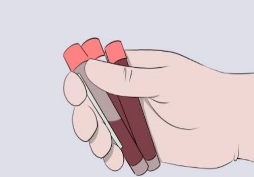 绍兴助孕生子：女性输卵管异常很麻烦，出现畸形可以这样处理