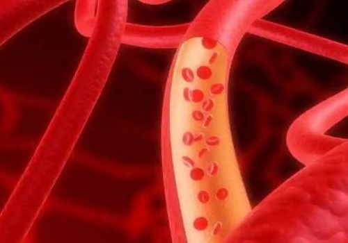 心绞痛有生命危险吗,出现心绞痛应该怎么办