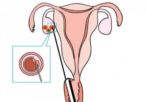 绍兴供精试管：新手爸妈育儿经验贴，附奶嘴型号和对应月龄