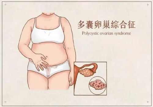 绍兴助孕机构：内膜6mm会宫腔粘连吗？宫腔粘连的原因要知道