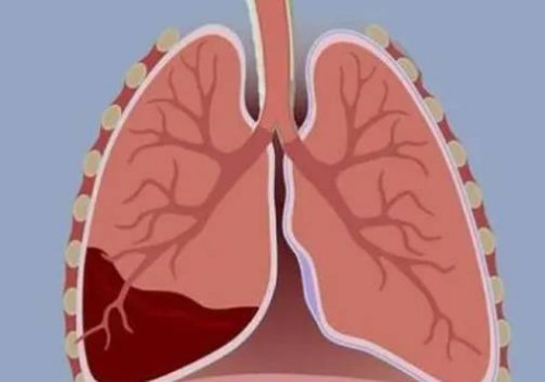 绍兴供精试管：宫颈管长度会发生变化，孕周增加会变得更短